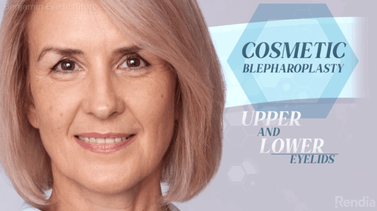 Blepharoplasty Recovery Guide: Eyelid Surgery Aftercare