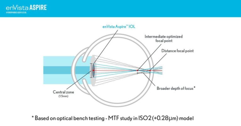 Introducing the Bausch and Lomb Aspire IOL: A New Standard in Vision Clarity