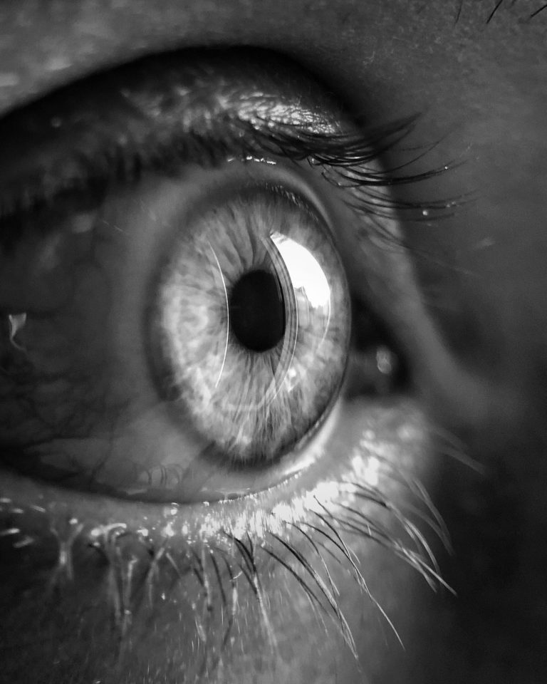 WHAT HAPPENS IF YOU HAD LASIK, BUT NOW HAVE CATARACTS?