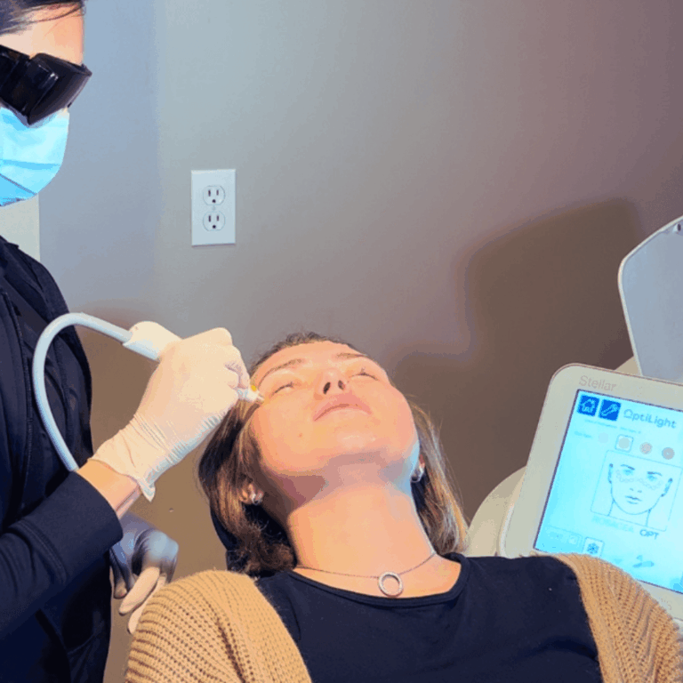 LUMENIS OPTILIGHT IPL DRY EYE TREATMENT. EXPLAINED