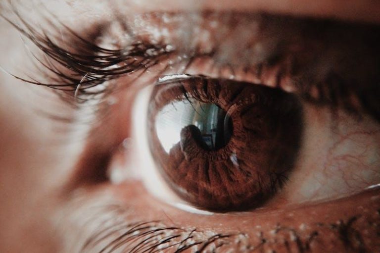TORIC LENSES: WHAT’S THE ATTRACTION?